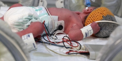 El MSP present las guas de "Orientaciones psicoafectivas para referentes familiares ante el nacimiento de su beb prematuro"